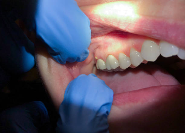 Best Dentist for Severe Toothache  in Logan, NM